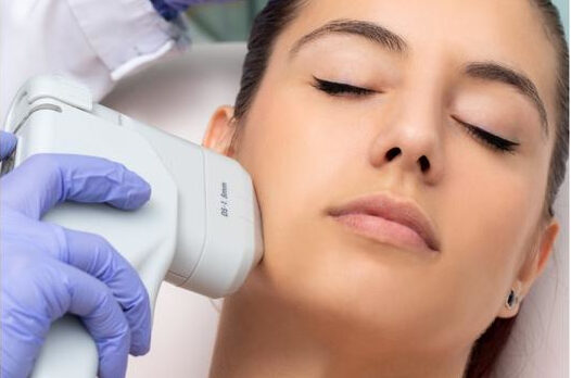 Mujer realizándose el servicio de hifu facial centro belleza granada