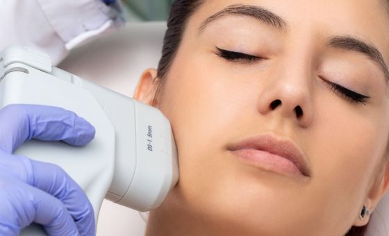 Mujer realizándose el tratamiento de hifu facial granada